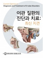 이관 질환의 진단과 치료: 최신 지견