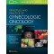 Principles and Practice of Gynecologic Oncology 7/e