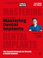 Mastering Dental Implants: The Essential Elements for Success in Dental Implants