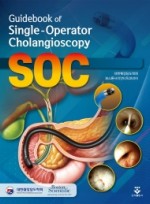 Guidebook of Single-Operator Cholangioscopy