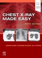 Chest X-Ray Made Easy 5e