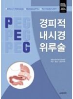 경피적내시경위루술 (PERCUTANEOUS ENDOSCOPIC GASTROSTOMY)