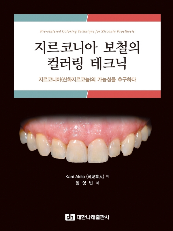 지르코니아 보철의 컬러링 테크닉