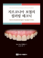 지르코니아 보철의 컬러링 테크닉