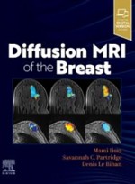 Diffusion MRI of the Breast