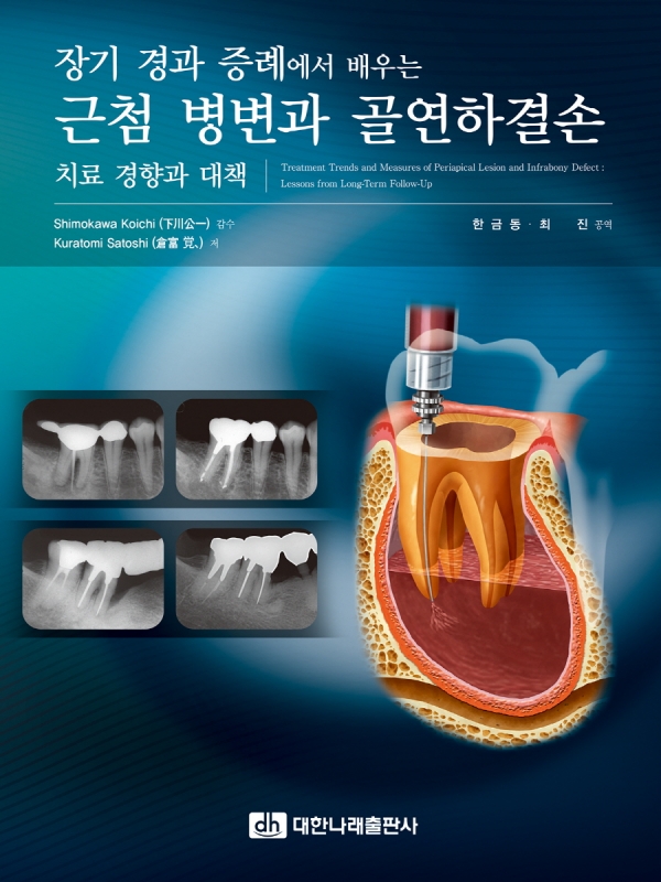 장기 경과 증례에서 배우는 근첨 병변과 골연하결손 치료 경향과 대책