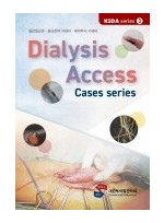 Dialysis Access - Case series /KSDA series 3