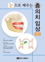 눈으로 배우는 총의치 임상 제2판