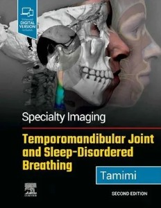 Specialty Imaging: Temporomandibular Joint and Sleep-Disordered Breathing,2/e