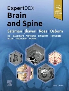 ExpertDDx: Brain and Spine,3/e