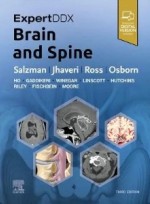ExpertDDx: Brain and Spine,3/e