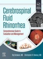 Cerebrospinal Fluid Rhinorrhea