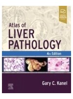 Atlas of Liver Pathology, 4th Edition