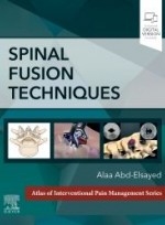 Spinal Fusion Techniques