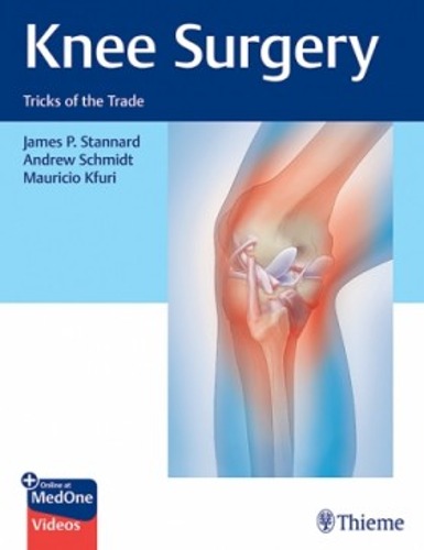 Knee Surgery: Tricks of the Trade