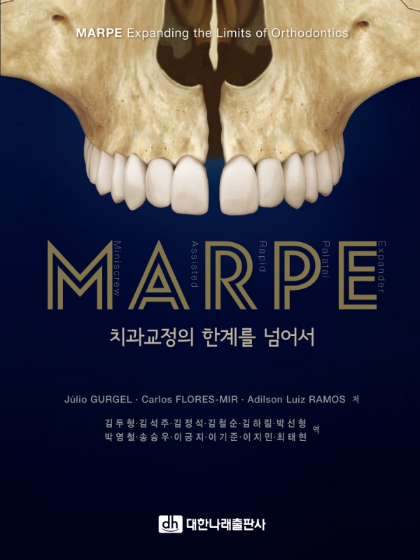 MARPE: 치과교정의 한계를 넘어서