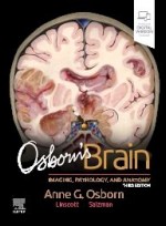 Osborn's Brain 3e