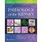 Heptinstall's Pathology of the Kidney ,8/e