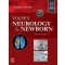 Volpe's Neurology of the Newborn,7/e