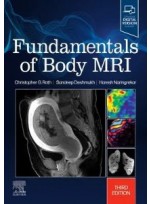 Fundamentals of Body MRI,3/e