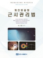 개인맞춤형 근시관리법