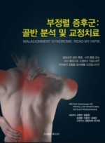 부정렬 증후군 : 골반 분석 및 교정 치료