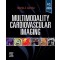 Multimodality Cardiovascular Imaging
