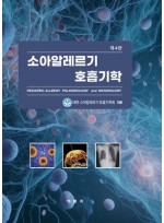 소아알레르기 호흡기학 4판
