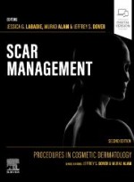 Procedures in Cosmetic Dermatology: Scar Management 2e