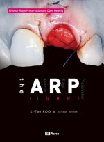 the ARP (iGBR)