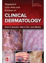 Fitzpatrick's Color Atlas and Synopsis of Clinical Dermatology 9e IE