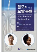 탈모와 모발 복원 개정3판 (Hair Loss and Restoration)