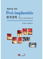 개원의를 위한 Peri-implantitis 완전정복
