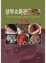상부소화관 ESD - 식도, 위, 십이지장 (웹 동영상 제공)