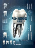 치과 임플란트 기공학