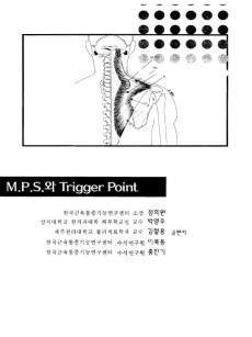 MPS와 Trigger Point
