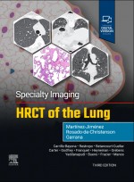 Specialty Imaging: HRCT of the Lung 3e