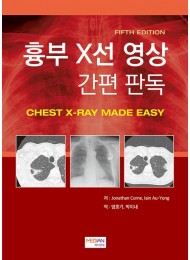 흉부 X선 영상 간편 판독 (Chest X-Ray Made Easy)