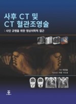 사후 CT 및 CT 혈관조영술: 사인 규명을 위한 영상의학적 접근