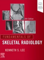 Fundamentals of Skeletal Radiology,6/e