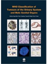 WHO Classification of Tumours of the Urinary System and Male Genital Organs