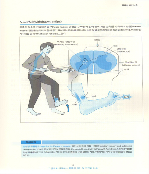 통증의 원인 및 진단과 치료 (그림으로 이해하는)