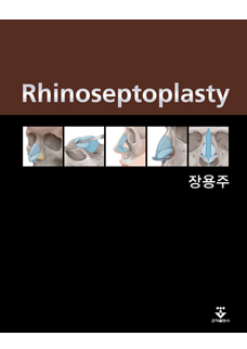 Rhinoseptoplasty(장용주)
