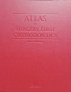 ATLAS Surgery First Orthodontics      