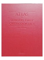 ATLAS Surgery First Orthodontics      