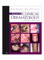 Atlas of Clinical Dermatology,4/e