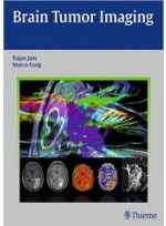 Brain Tumor Imaging