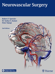 Neurovascular Surgery,2/e