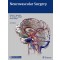 Neurovascular Surgery,2/e