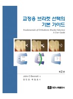 교정용 브라켓 선택의 기본 가이드,2판 